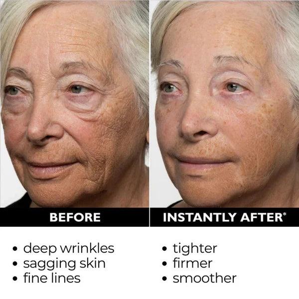 Temporary Face Tightener