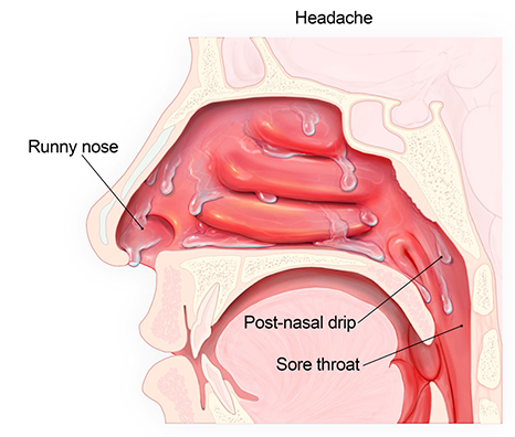 RespiRelief Red Light Nasal Therapy Instrument