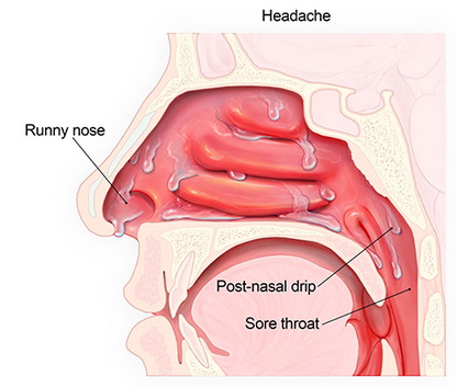 RespiRelief Red Light Nasal Therapy Instrument