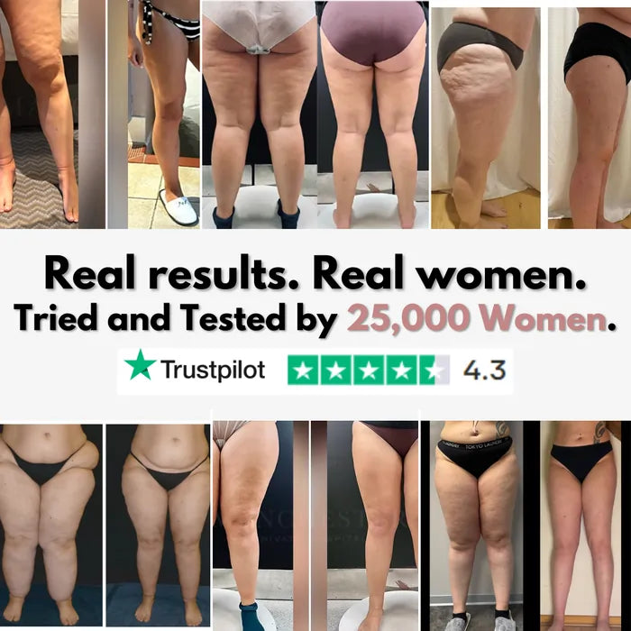 Stycove 3D Legging – Say goodbye to lipoedema pain and swelling naturally
