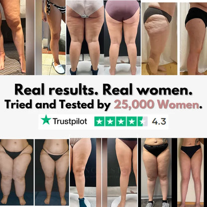 Stycove 3D Legging – Say goodbye to lipoedema pain and swelling naturally
