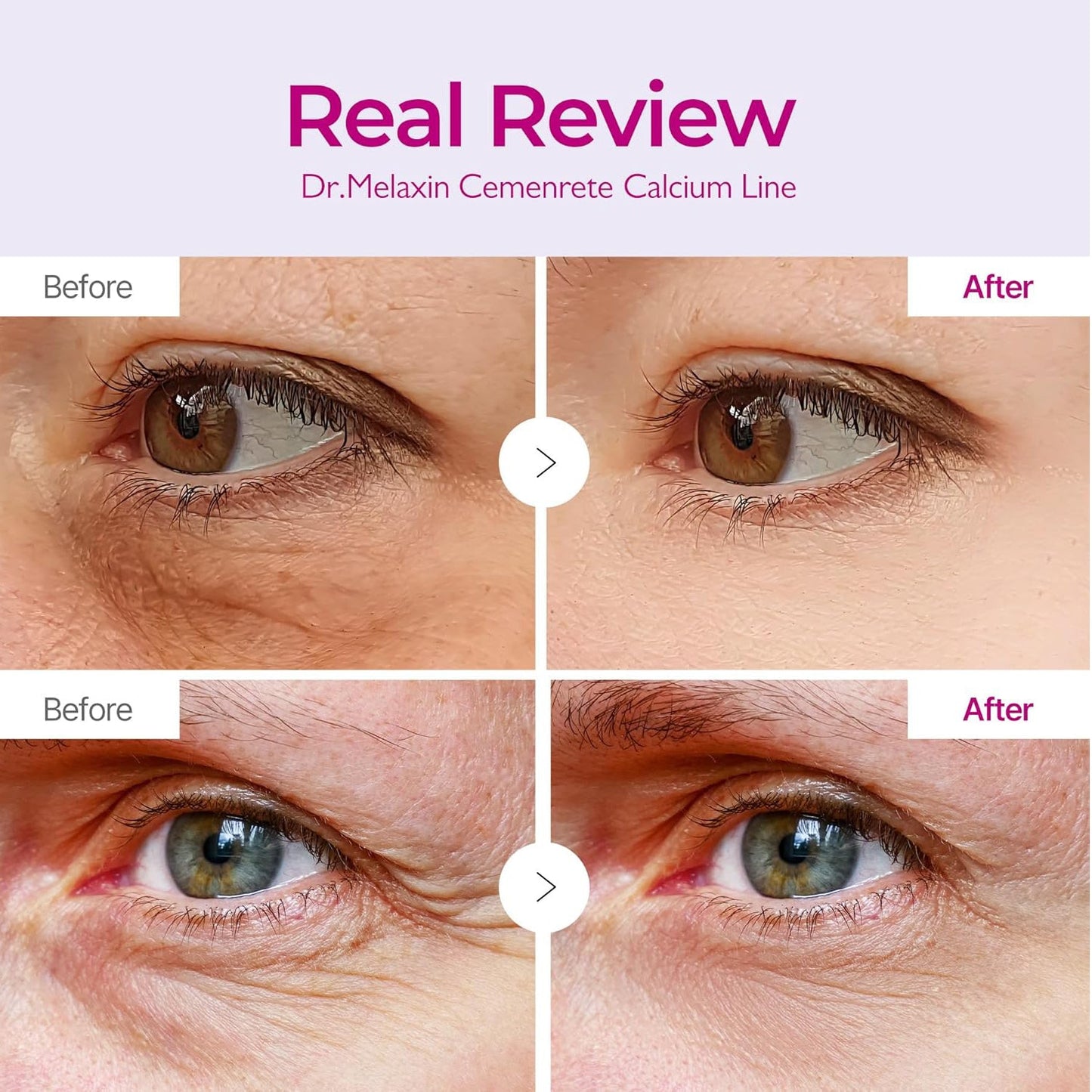 Cemenrete Calcium Dark Spot Eye Cream
