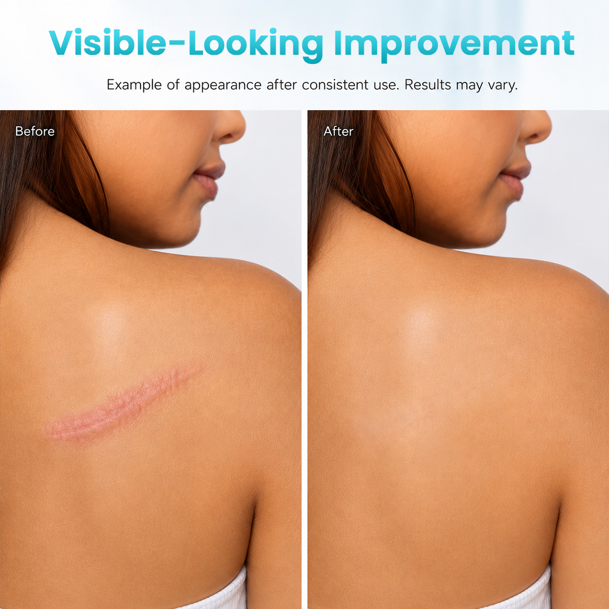 Advanced Scar Repair Cream – Smooth & Improve the Appearance of Scars