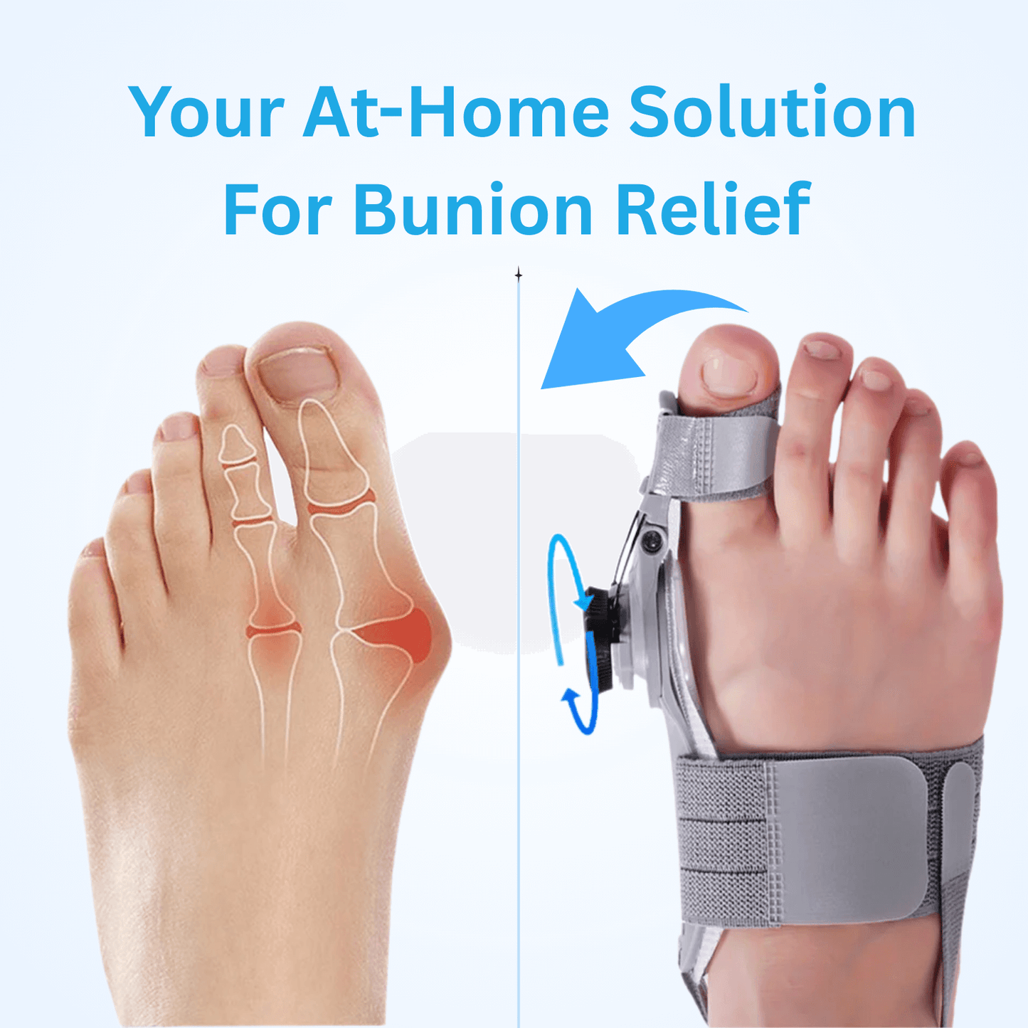 Stycove Bunion Corrector