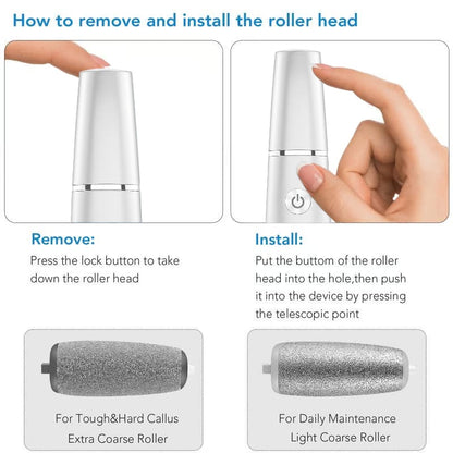 Electric Feet Callus Remover