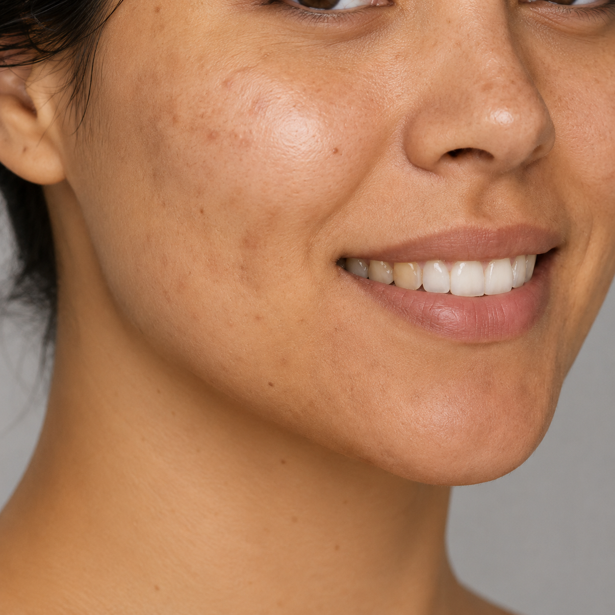 Skin with visible dark spots and uneven-looking tone