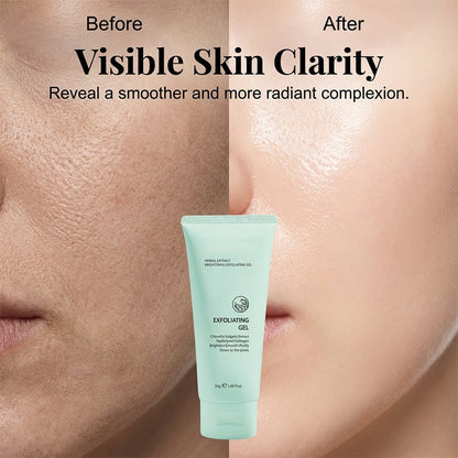 Herbal Extract Brightening Exfoliating Gel