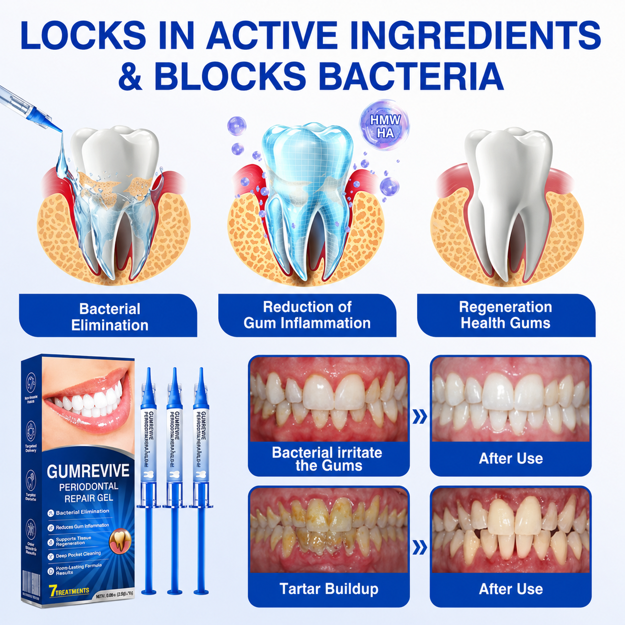 Periodontal Repair Gel