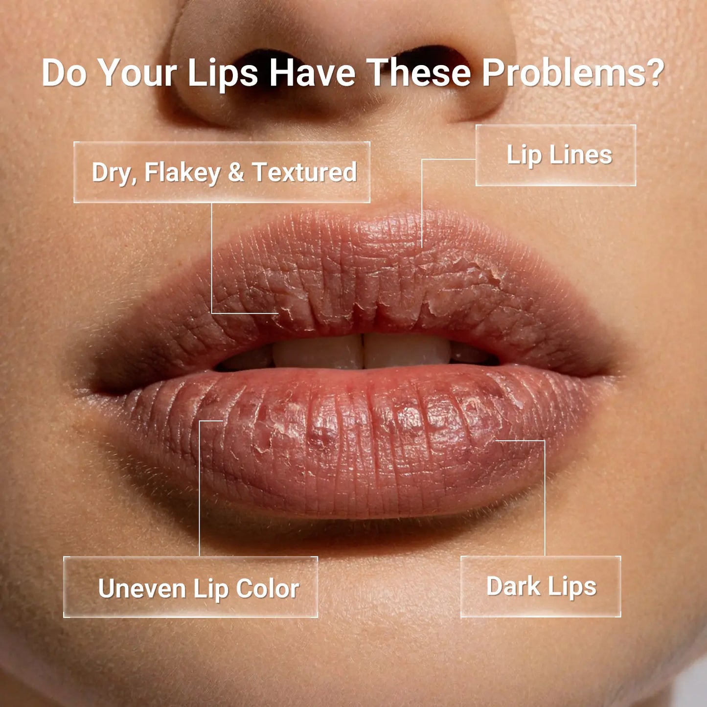 Peptide Lip Serum for Lip Hydration & Repair