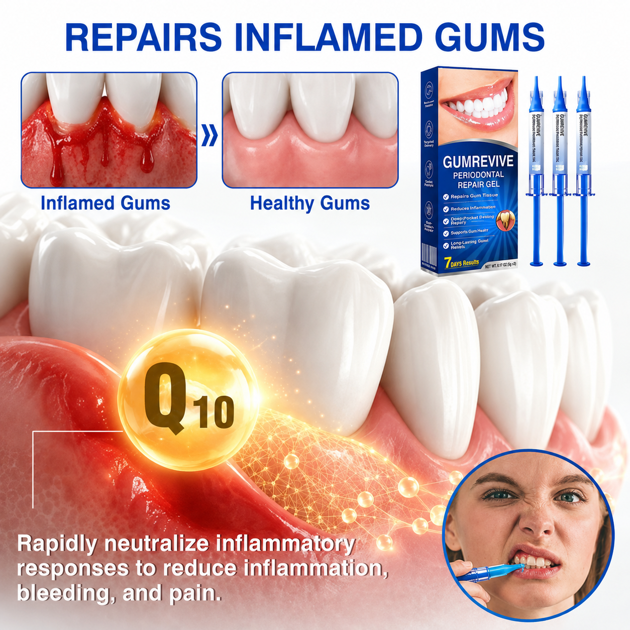 Periodontal Repair Gel