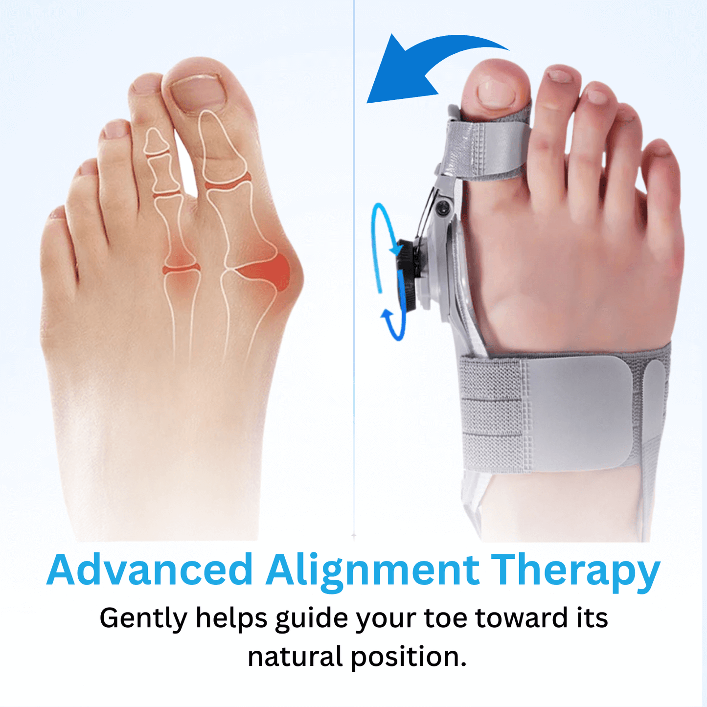Stycove Bunion Corrector