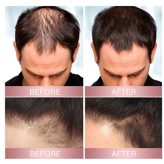 hair growth spray