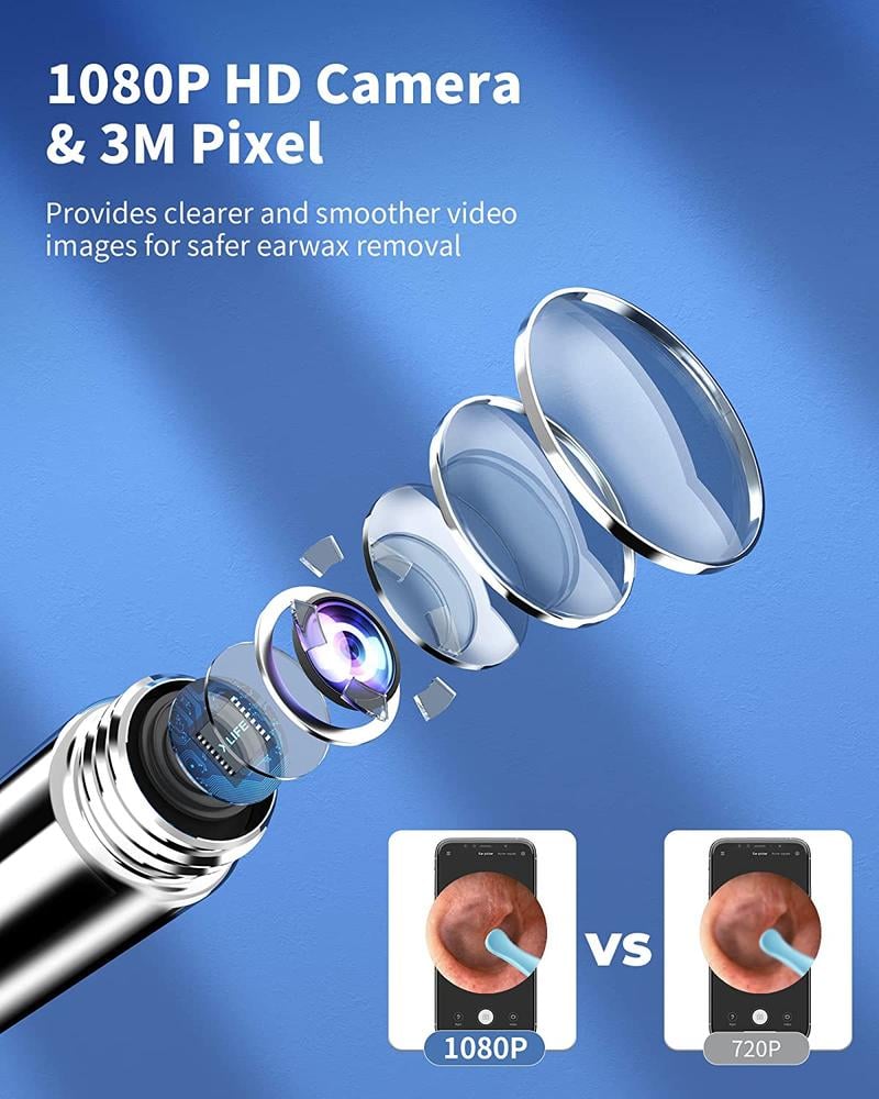 Wi-Fi Visible WaxRemoval Spoon,USB 1296P HD Load Otoscope
