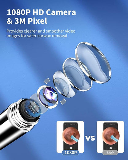 Wi-Fi Visible WaxRemoval Spoon,USB 1296P HD Load Otoscope