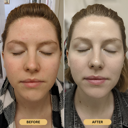 Exnotic—Gel With Vitamin C Capsule Cream