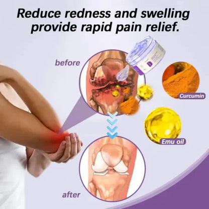 Curcumin & Emu Oil Pain Gel – Backed by US Osteopathic Experts