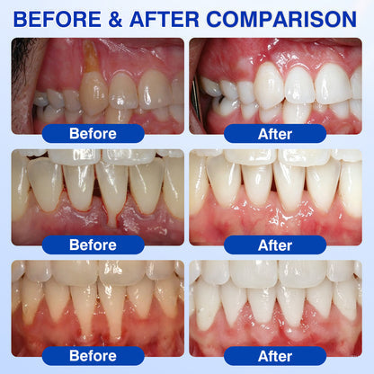 Periodontal Repair Gel