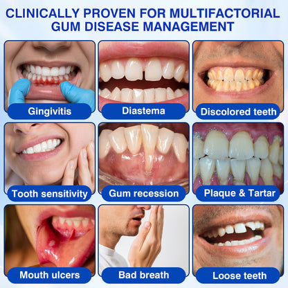 Periodontal Repair Gel