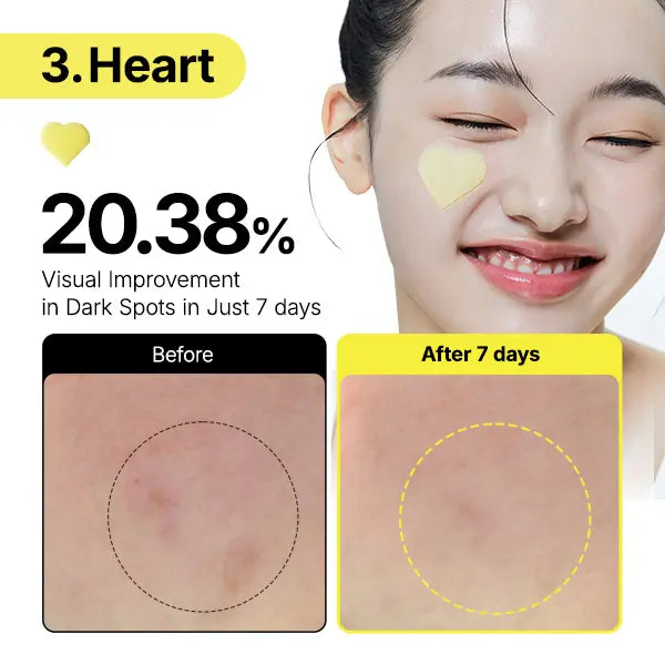 [Dark Spot Patch]Glutathione 7 Dark Spot Serum Patch