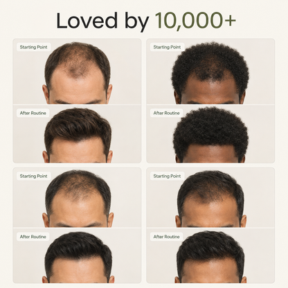 Korean Scalp Repair Bar for Men