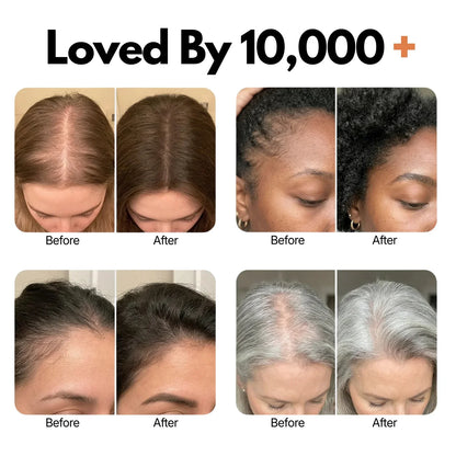 Stycove Hair Growth Serum
