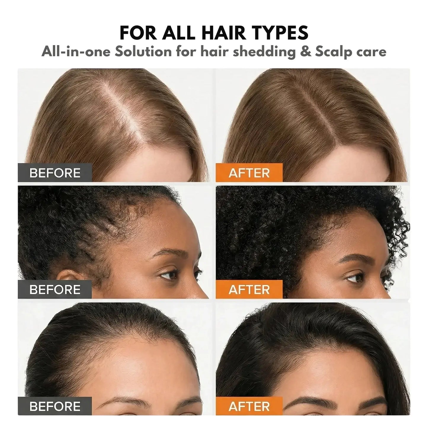 Stycove Hair Growth Serum
