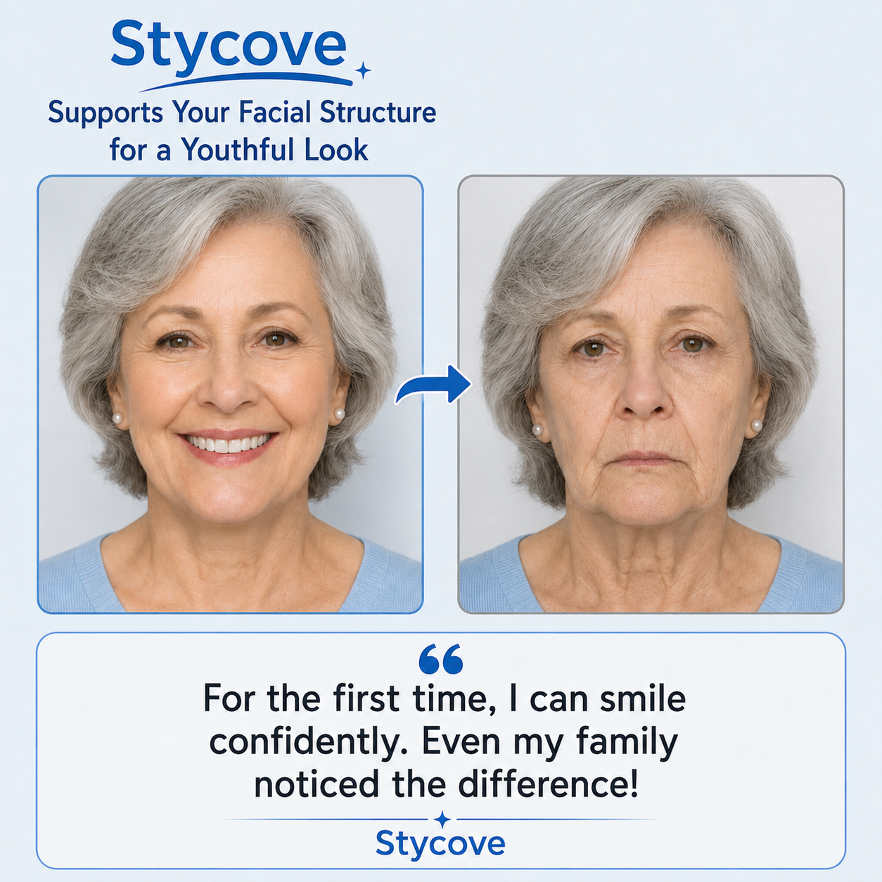 Custom-Fit Dentures for Everyday Comfort