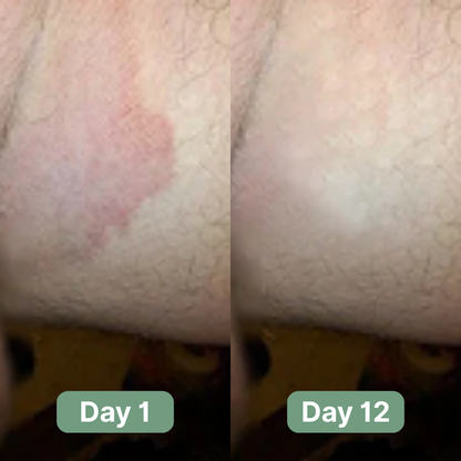 Andrew's Antifungal Soap