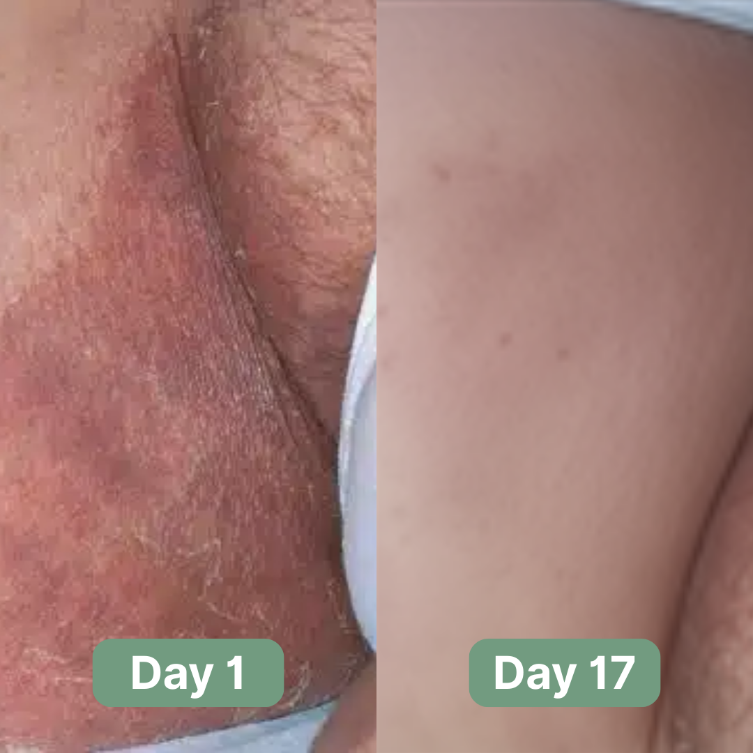 Andrew's Antifungal Soap