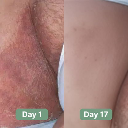 Andrew's Antifungal Soap