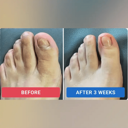 Nail Repair Patches