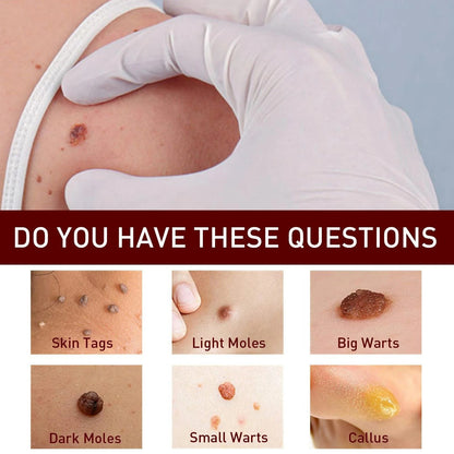 Best Sellers - Tags & Moles Remover——10 pcs