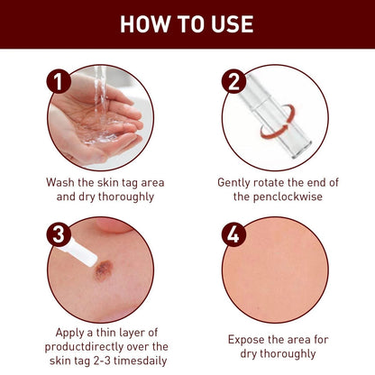 Best Sellers - Tags & Moles Remover——10 pcs