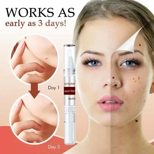 Best Sellers - Tags & Moles Remover——10 pcs